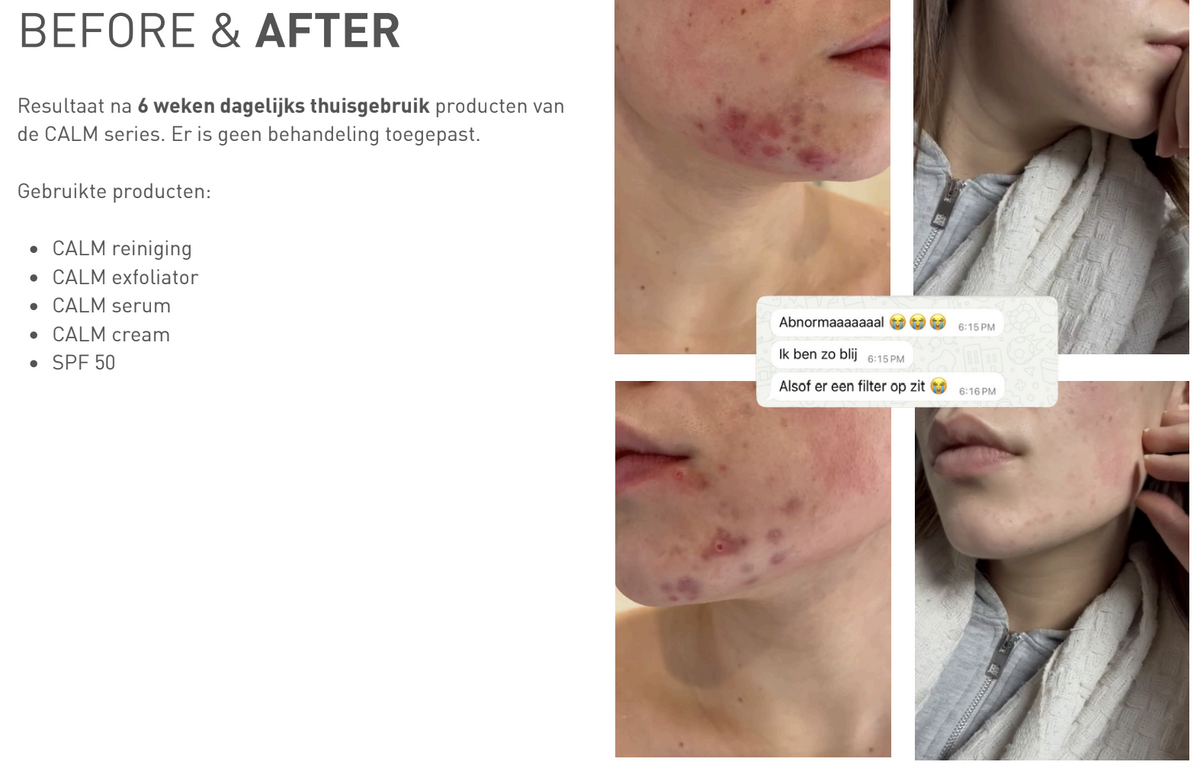 Calm Serum